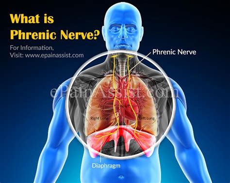 Sharp, aching or burning pain, which may radiate outward. . How long does phrenic nerve irritation last